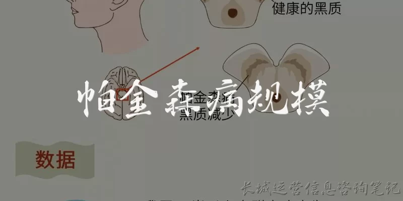 帕金森病规模:全球帕金森病的规模有多大?